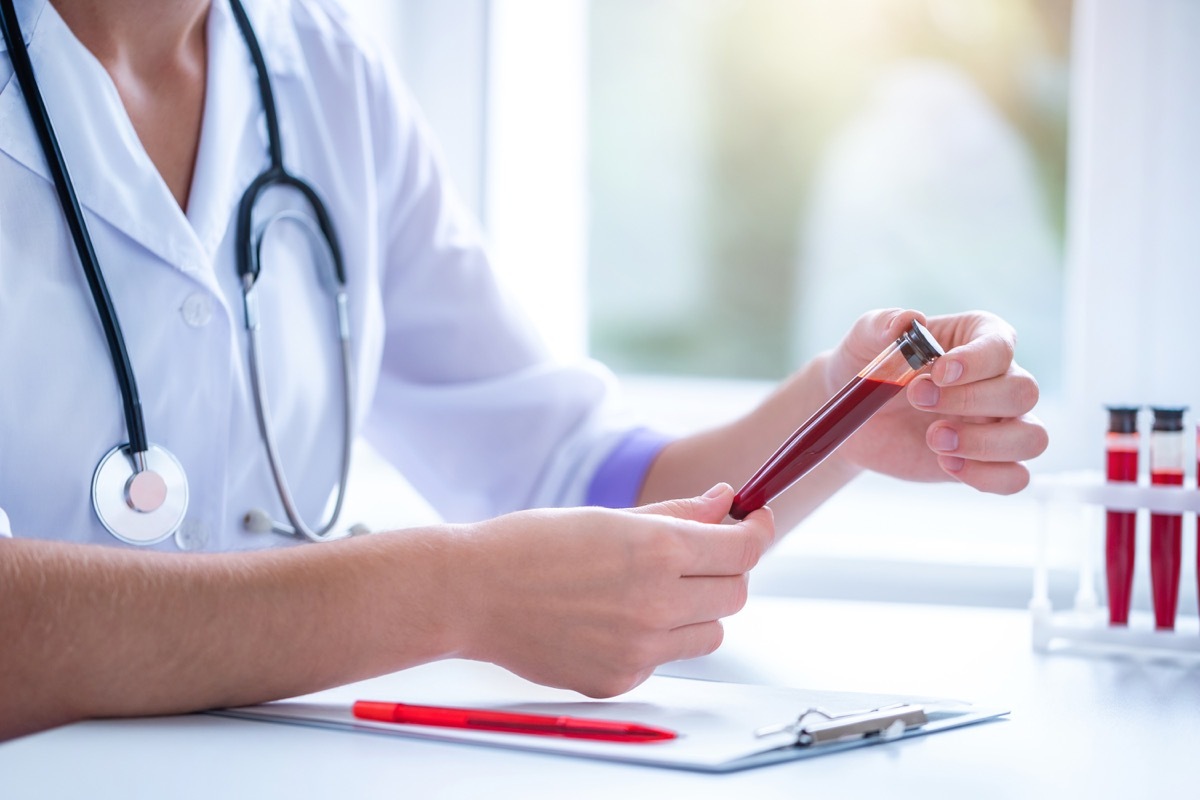 Doctor looking at vial of blood