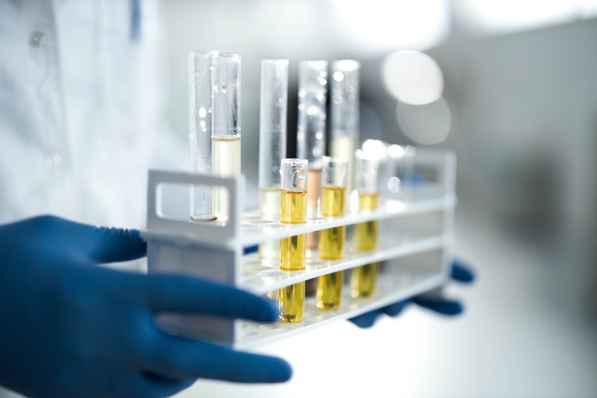 Close up of unrecognizable chemist holding large group of test tubes with essential oil in laboratory.