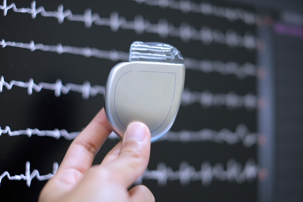 This image demonstrates Implantable cardioverter defibrillator (ICDs) on hands