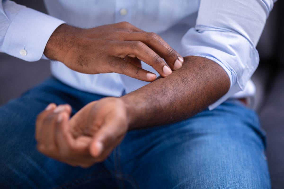 Close-up Of An African Man Scratching His arm