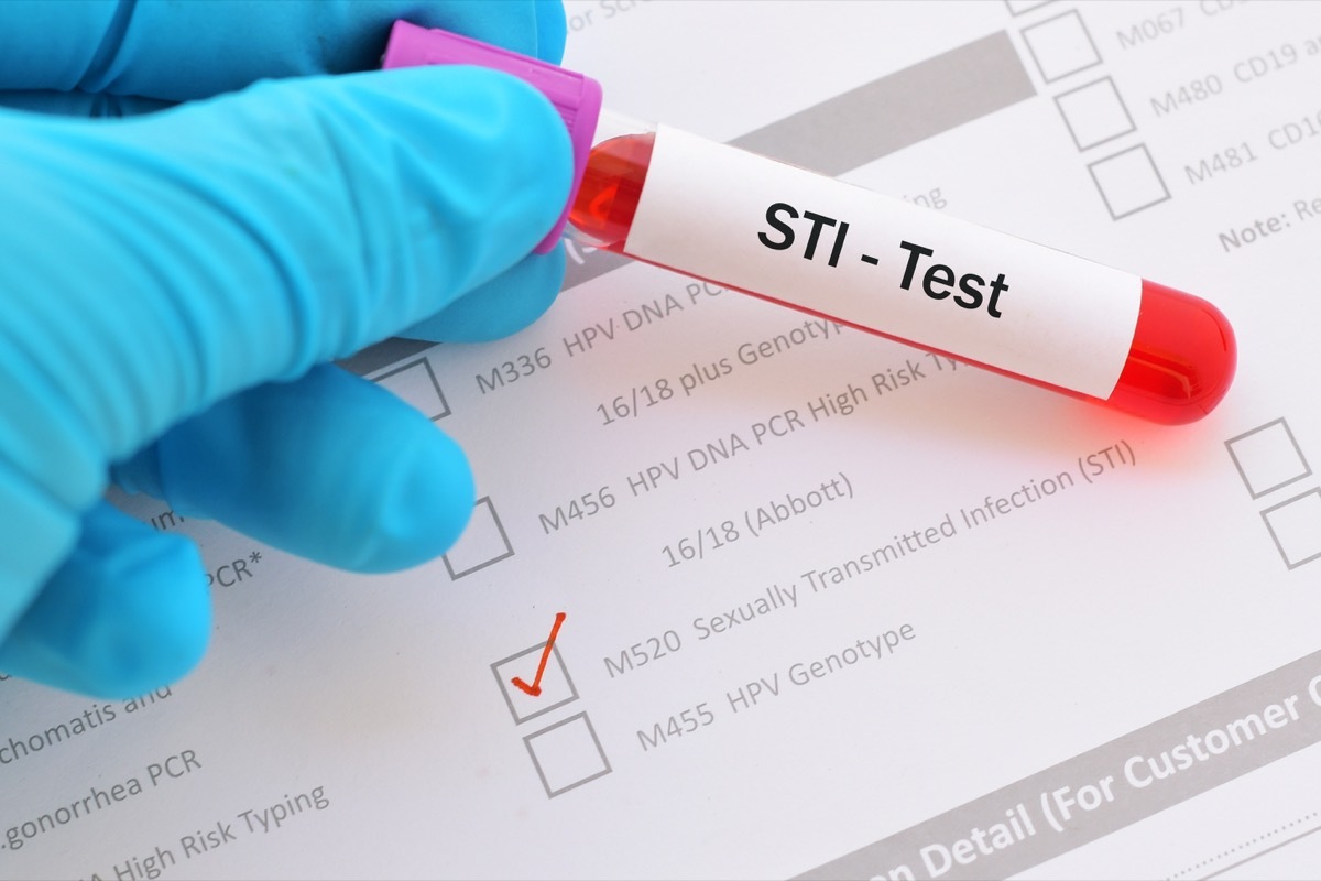 lood sample for STI (sexually transmitted infection) test -