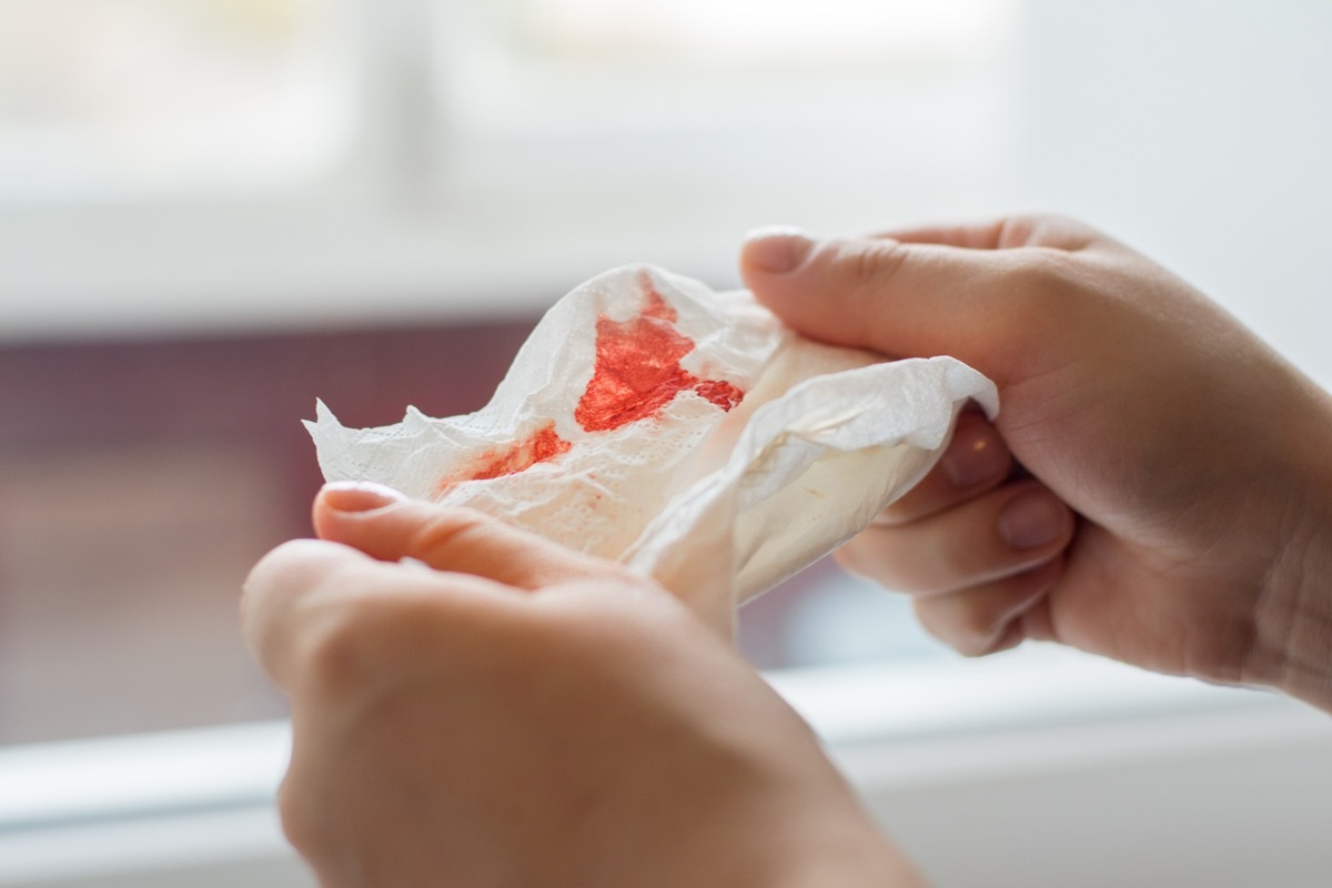 Blood covered tissue