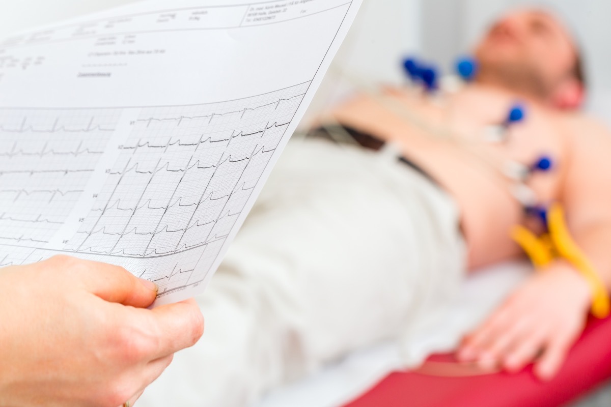 Female doctor analyzing ECG electrocardiogram of patient in hospital