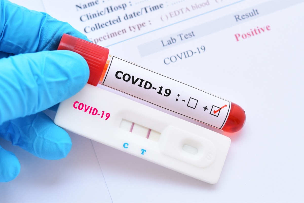 Coronavirus test