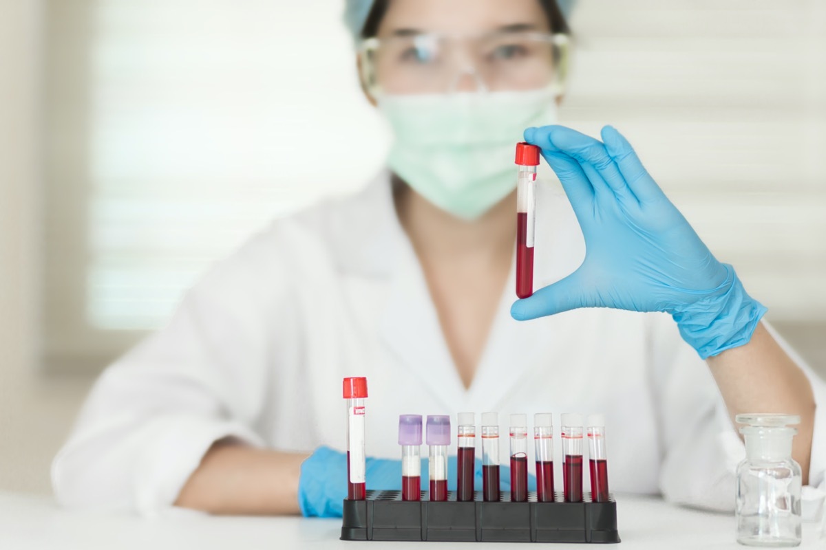 Female Technician holding blood tube test, a rack of blood samples Tubes of patients in laboratory in the hospital.